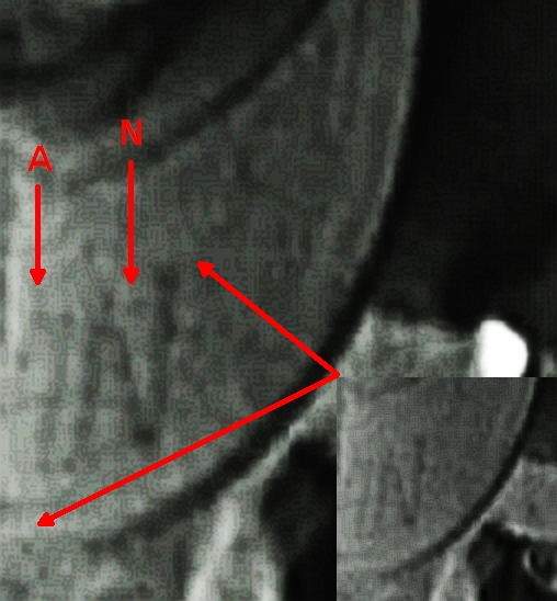 Second Lieutenant Norman Gertz